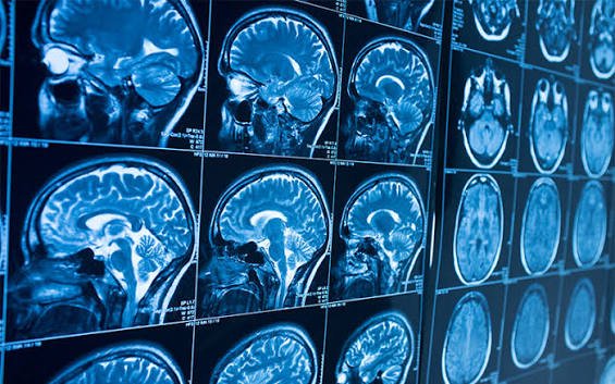 Neurosciences